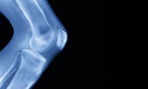 knee